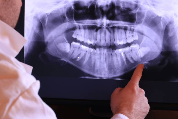 Best Emergency Wisdom Tooth Extraction in Cedville, AR