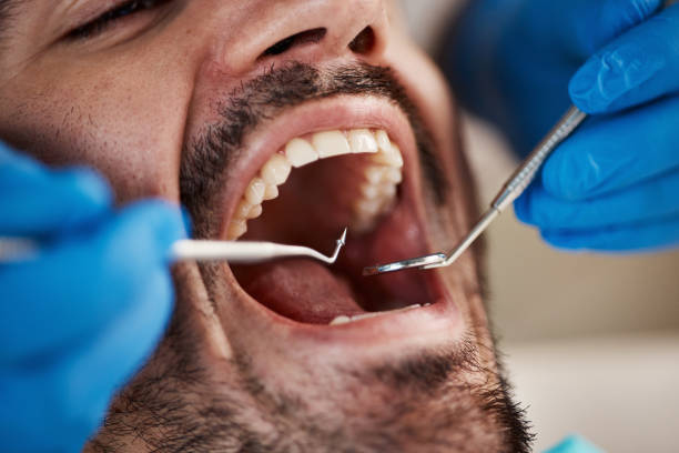 Best Emergency Dental Care for Sports Injuries in Cedville, AR