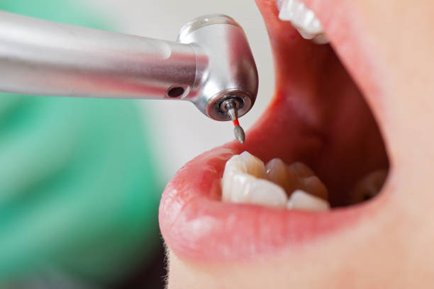 Best Broken or Chipped Tooth Repair in Cedville, AR